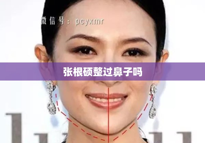 张根硕整过鼻子吗