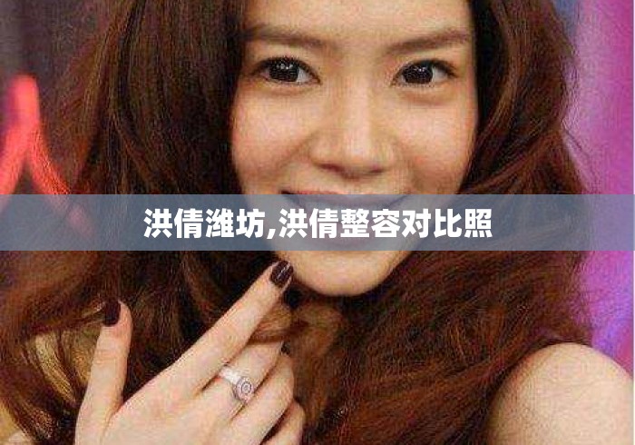 洪倩潍坊,洪倩整容对比照 洪倩潍坊,洪倩整容对比照